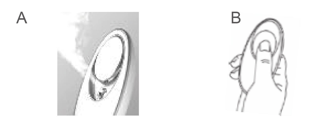 ミスト機器を使うAB